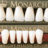 ACRYLIC TEETH